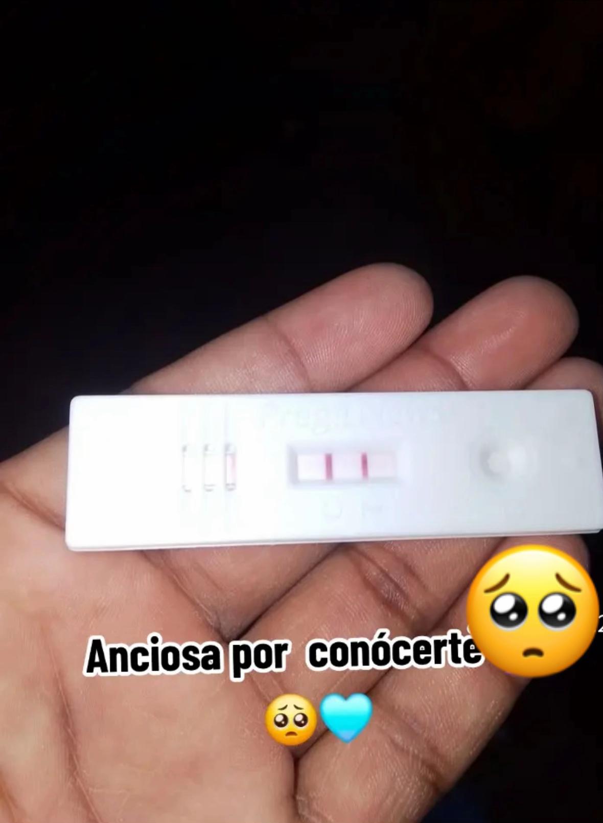 @Rossmy ๐