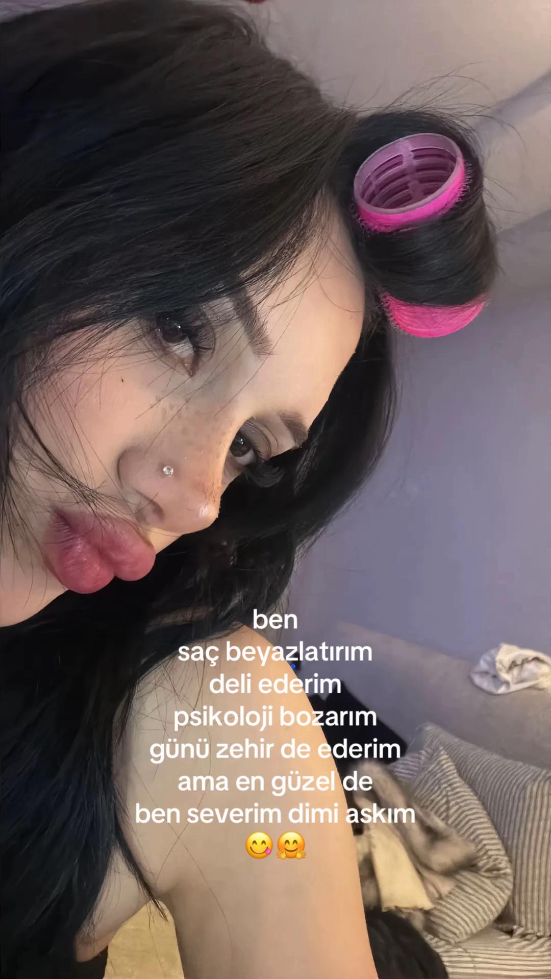 @sla🇹🇷