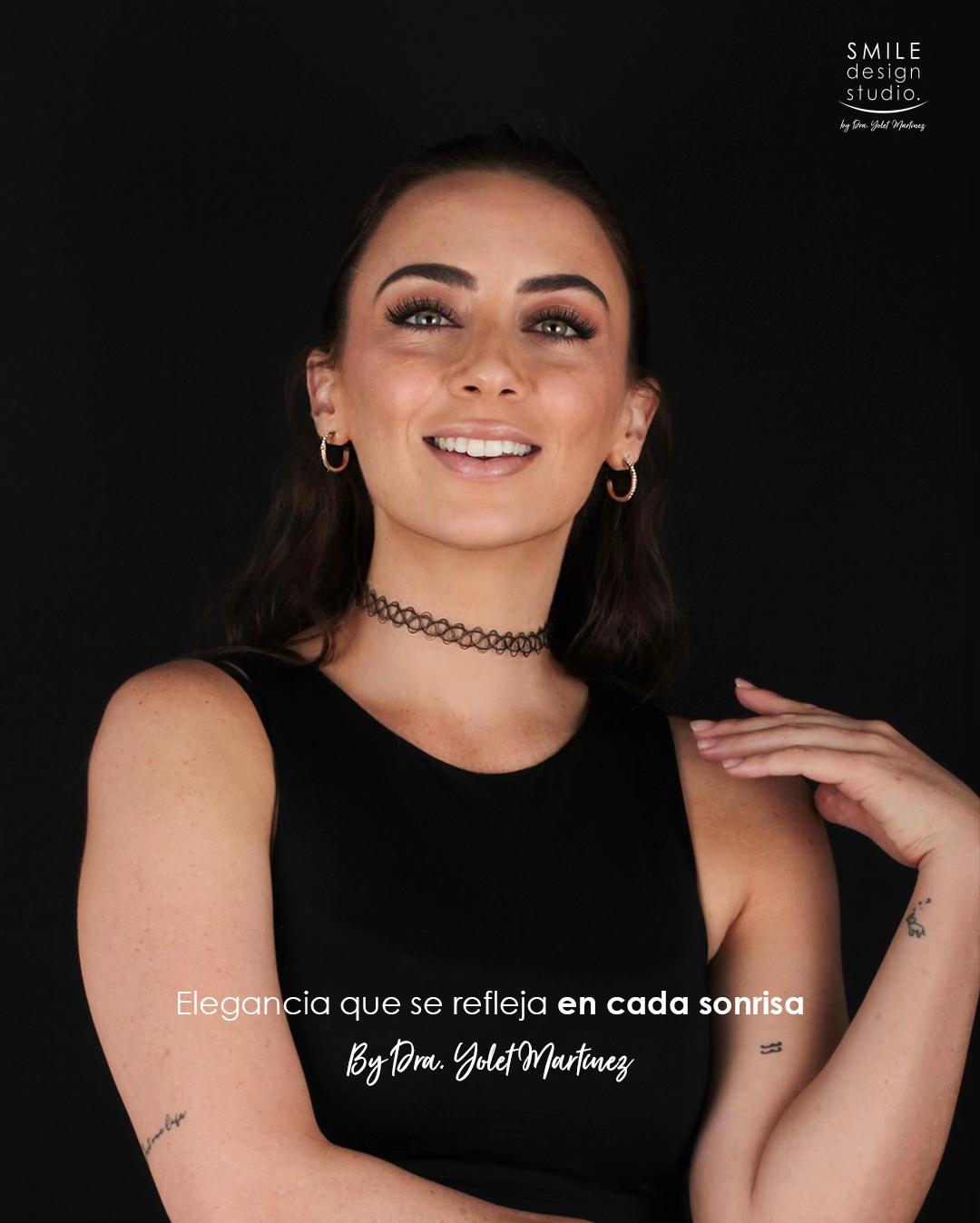 @SmileDesignStudio