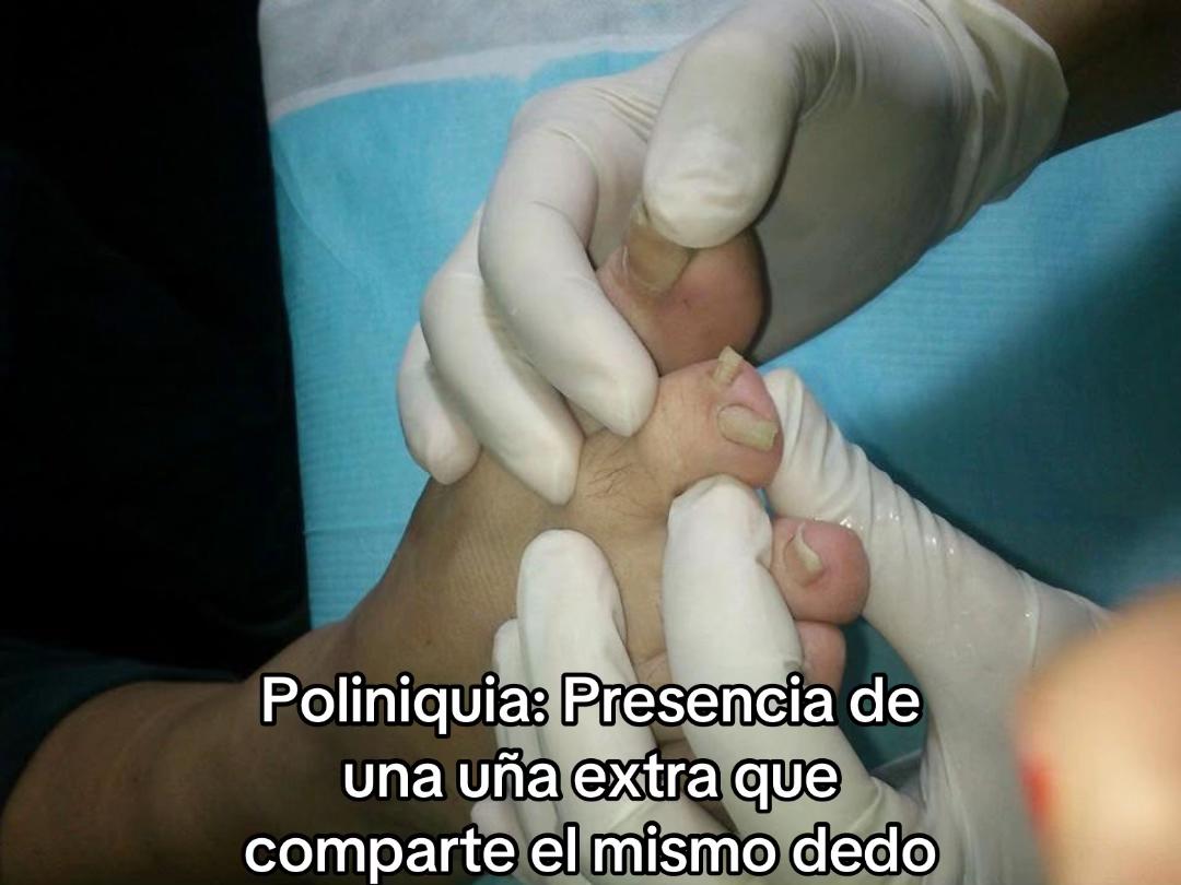 @Pod&oacute;logia Nordelta