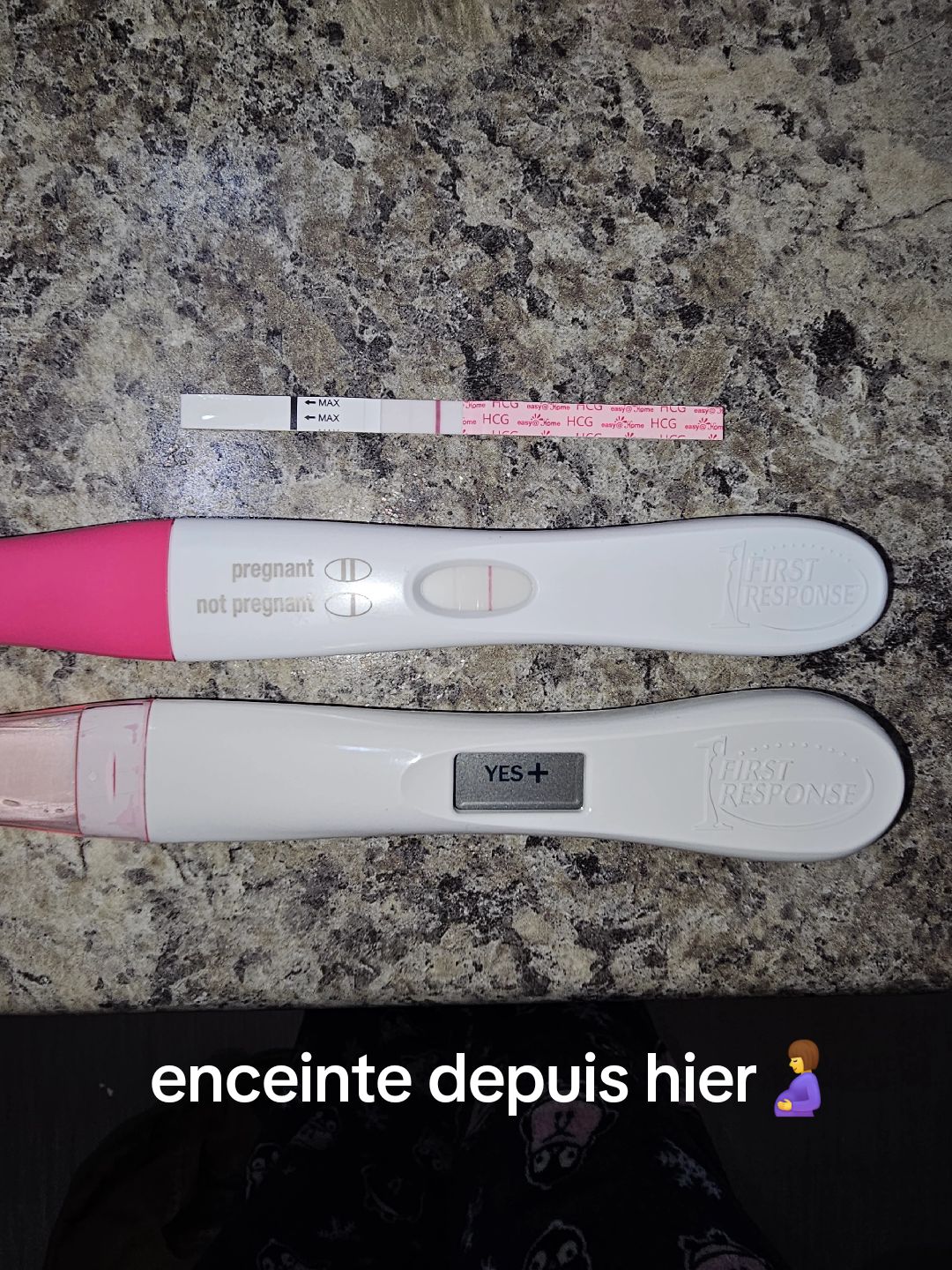 @Alison St-hilaire