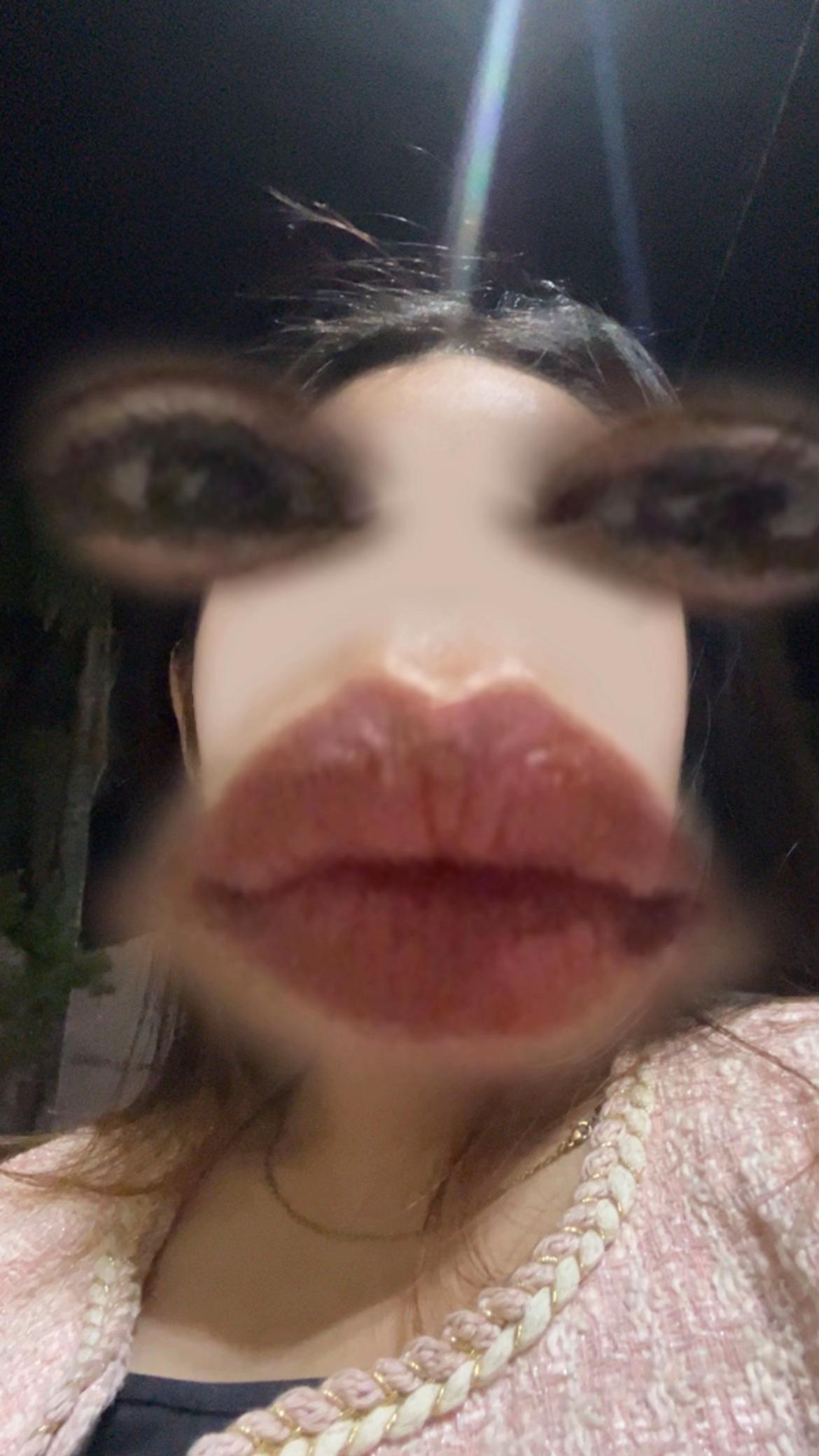 @💋