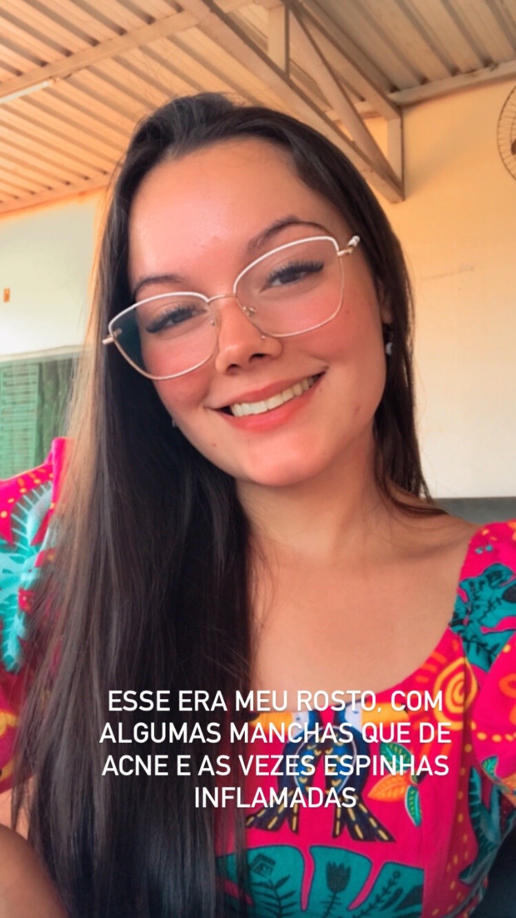@Stephany