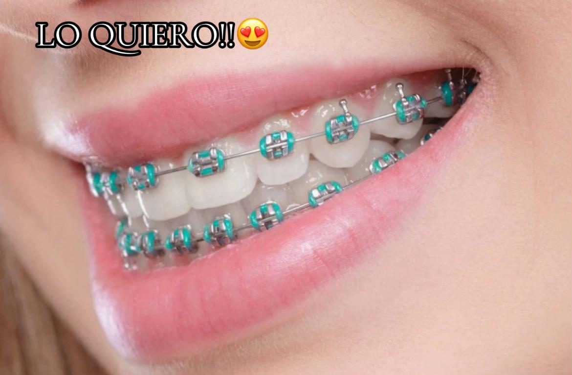 @⁹⁰𝙇𝙯 ㊙️