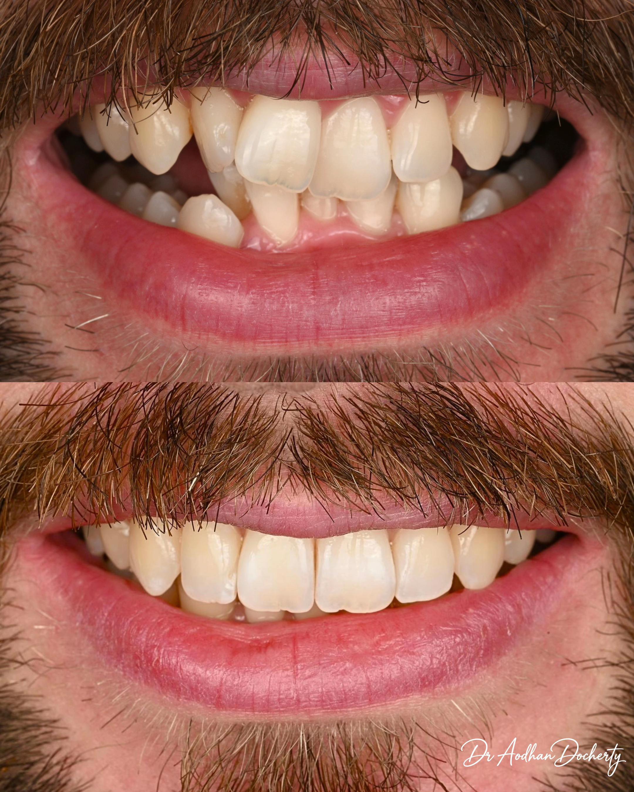 @Sydney Dentist | Dr Aodhan