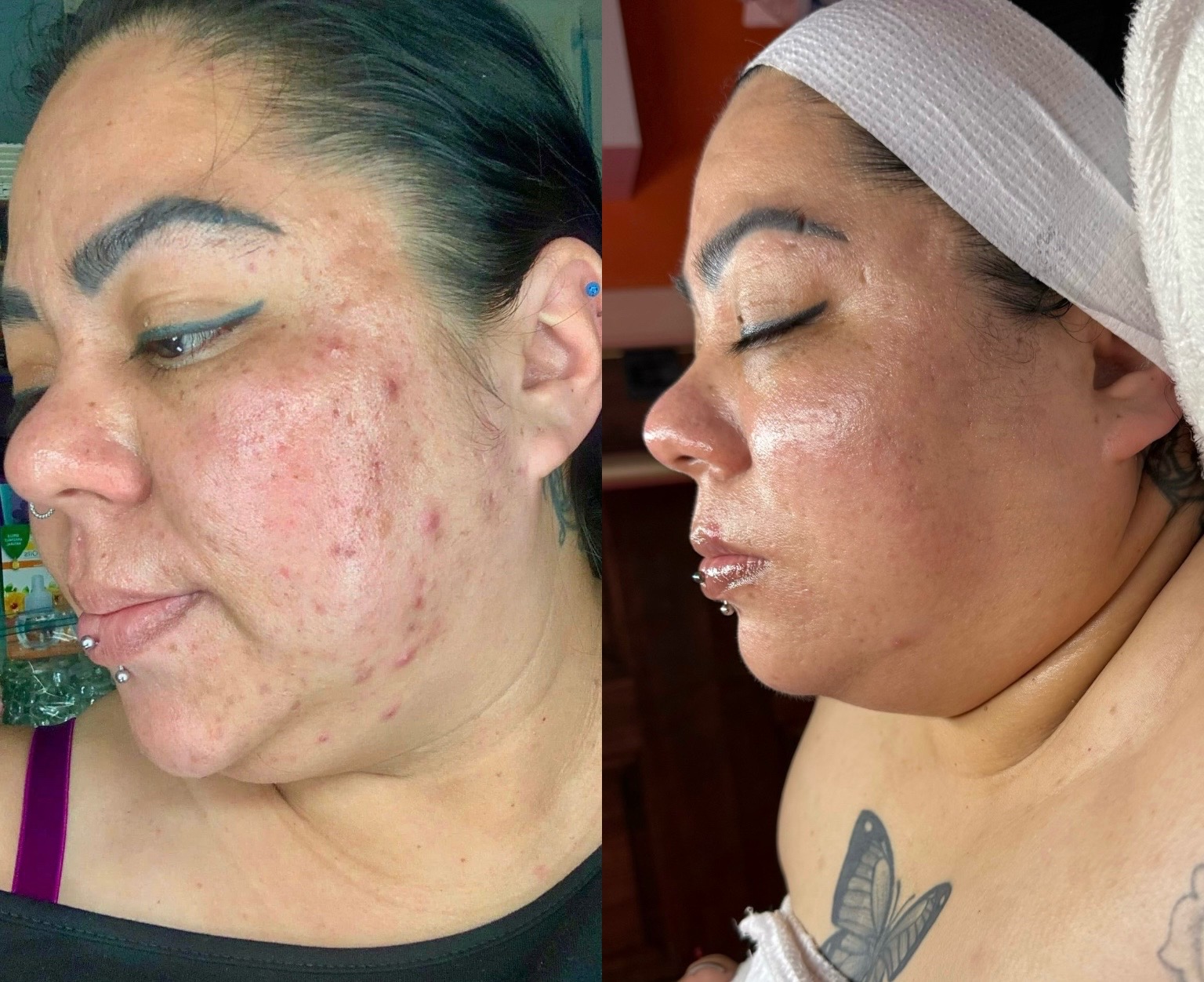 @HappySkinBySara
