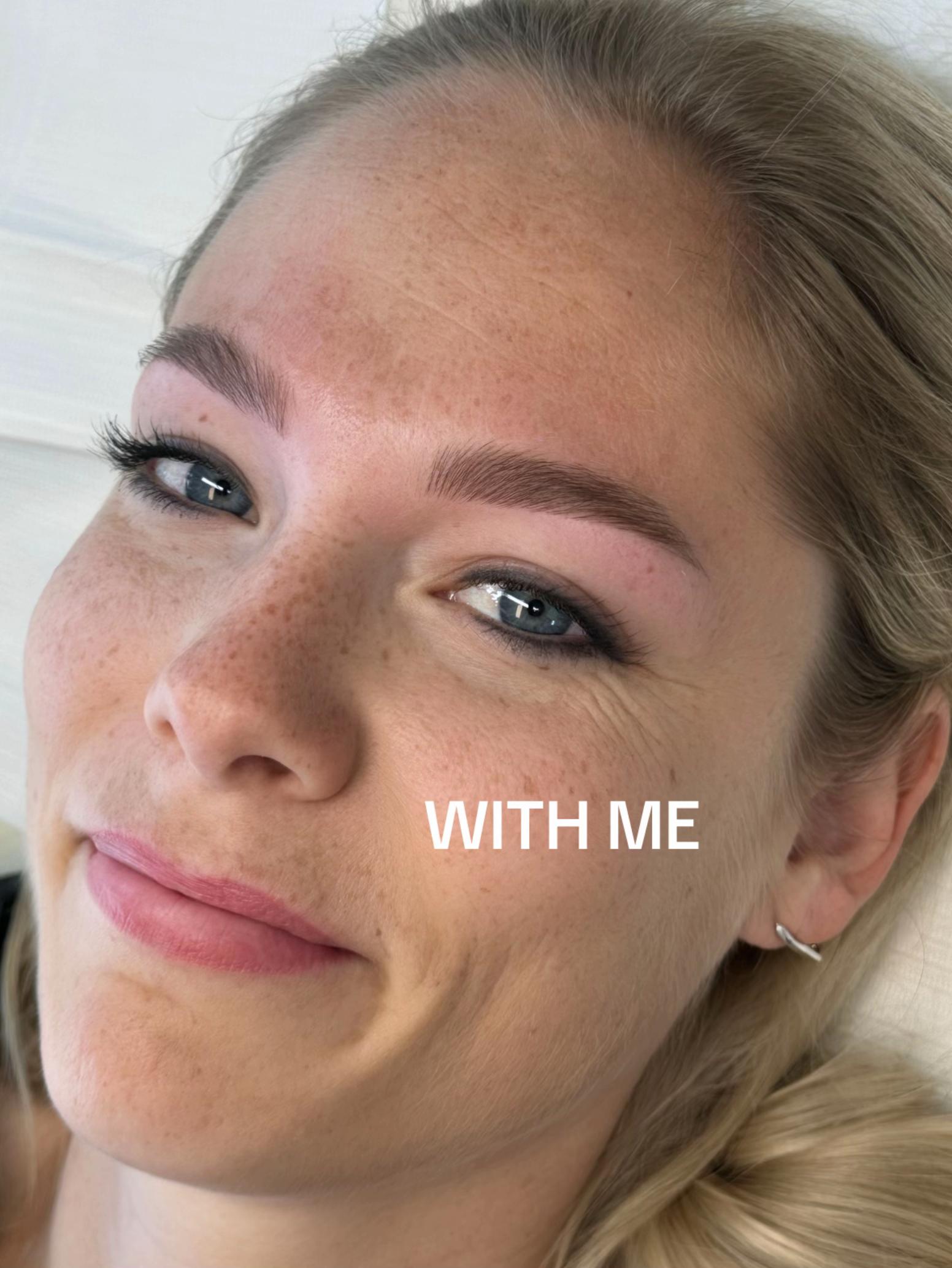 @Laura