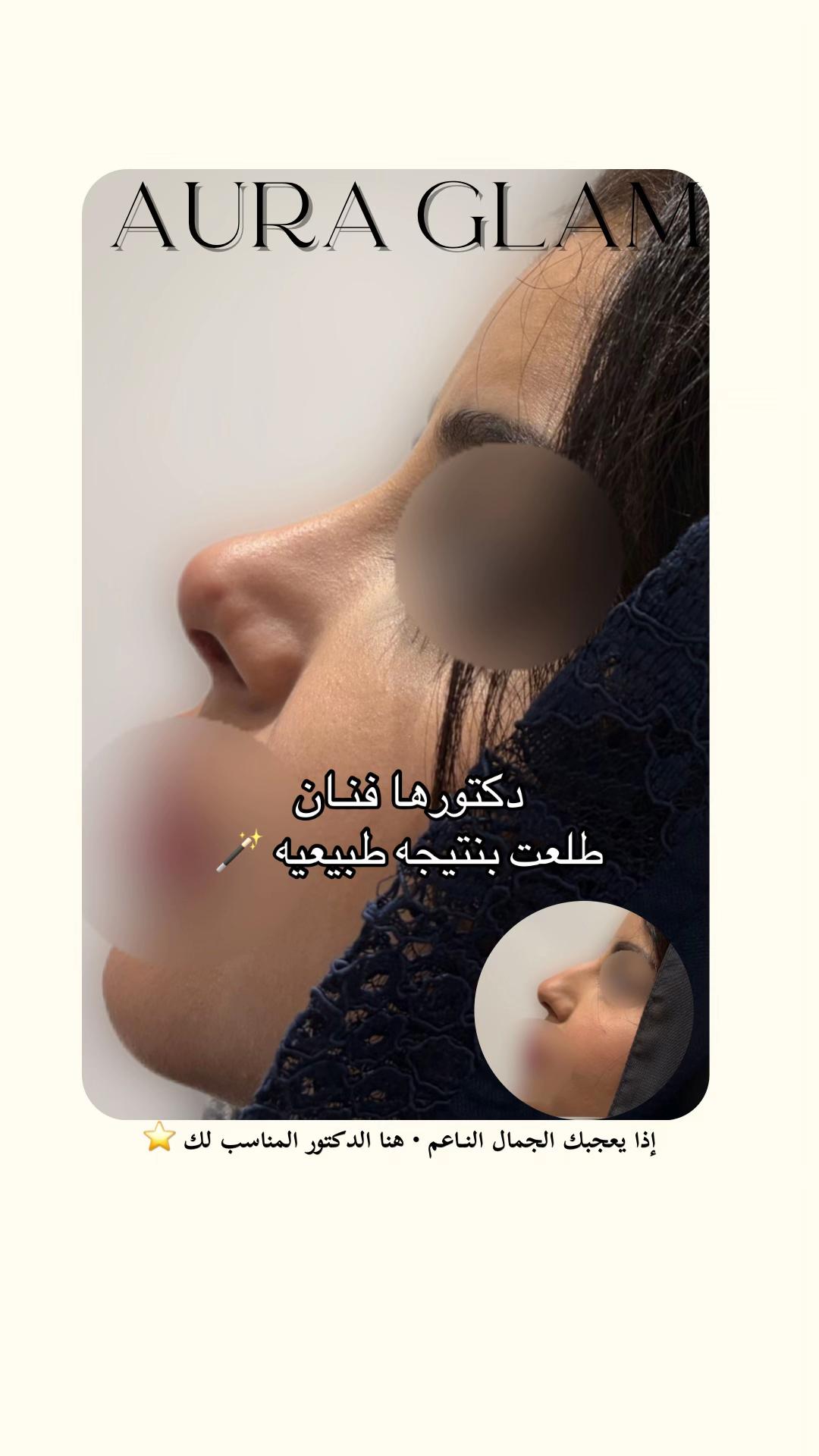 @AURA GLAM | أورا قلام