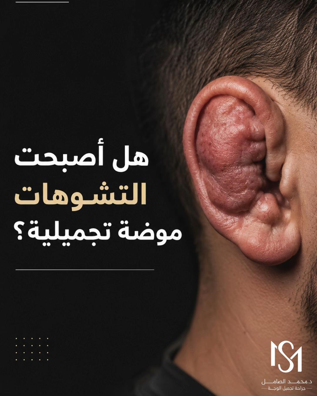 @د. محمد الصامل