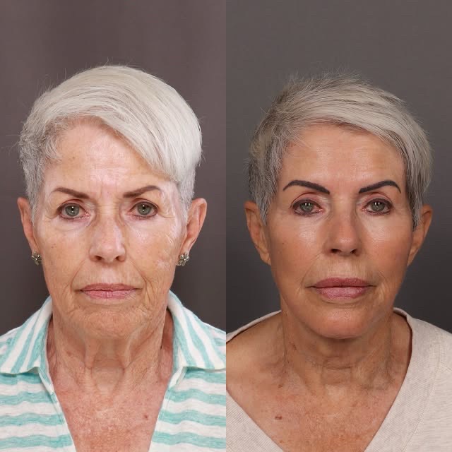 @Xue Skin & Contour