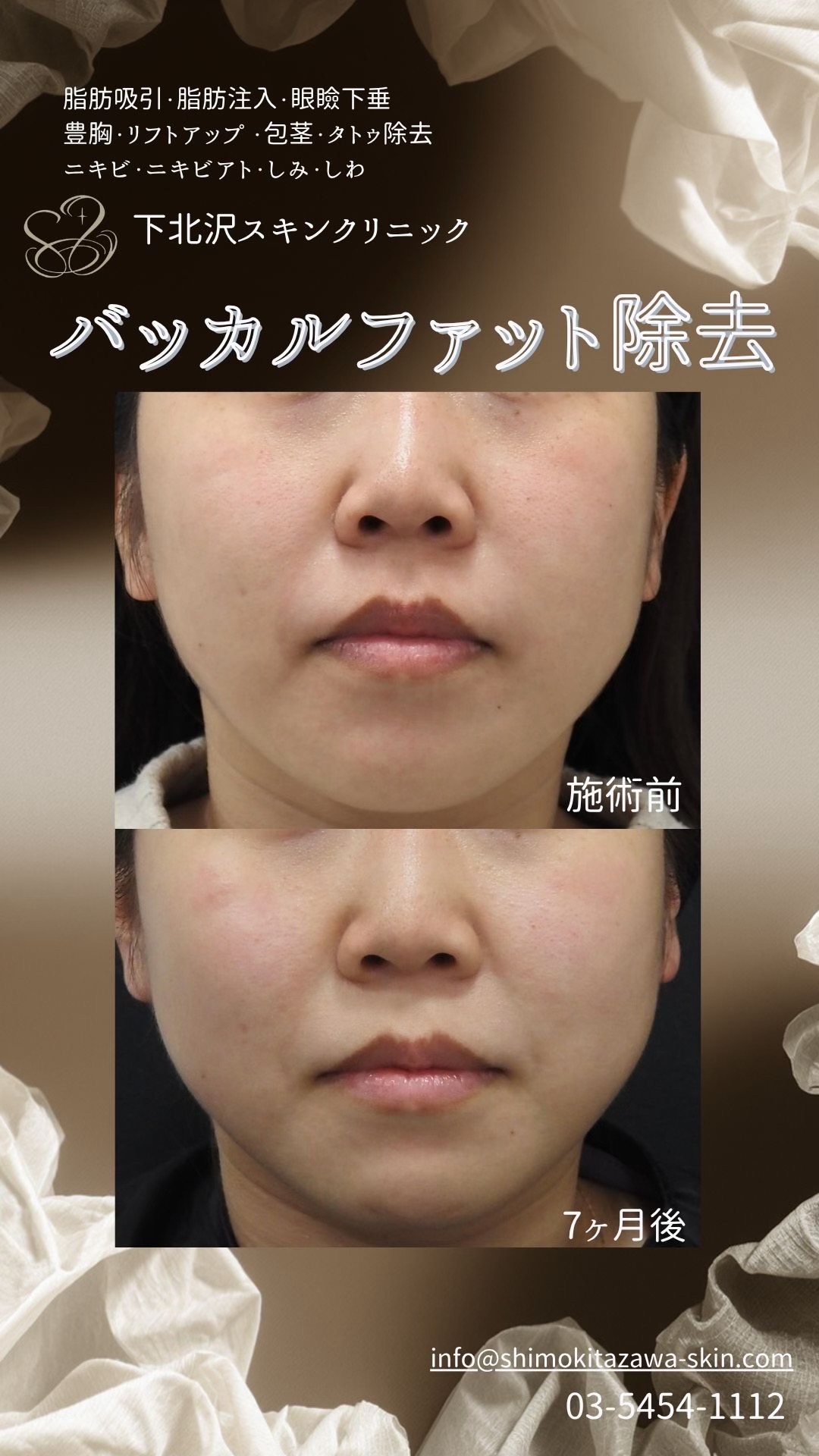 @下北沢スキンクリニック院長・こころの美容外科医・保坂宗孝
