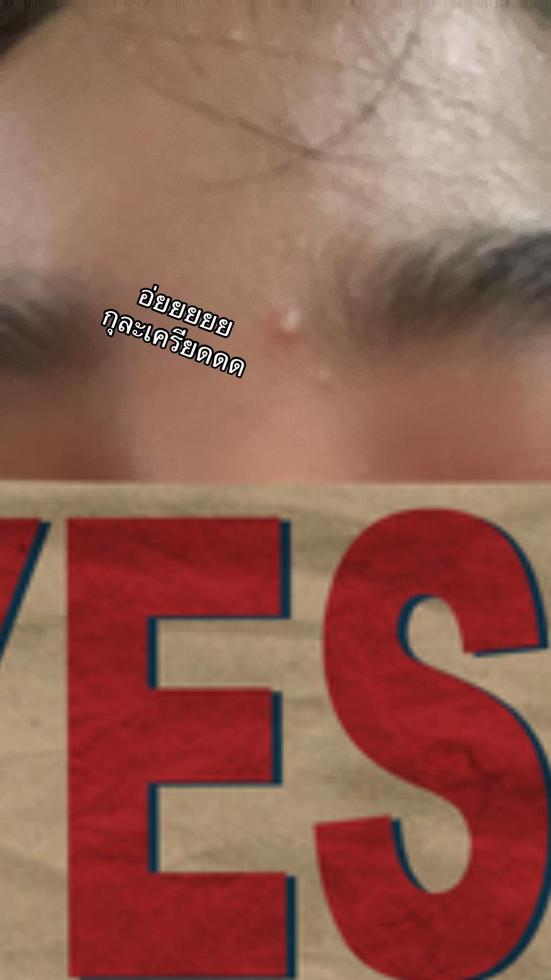 @ 