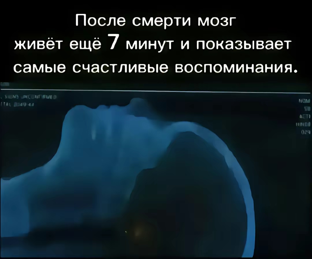 @Millchik