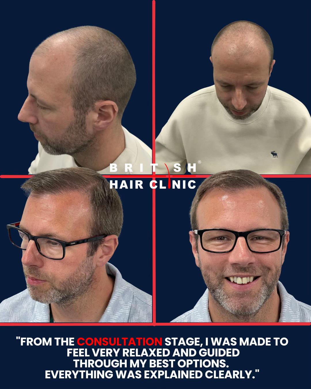 @British Hair Clinic