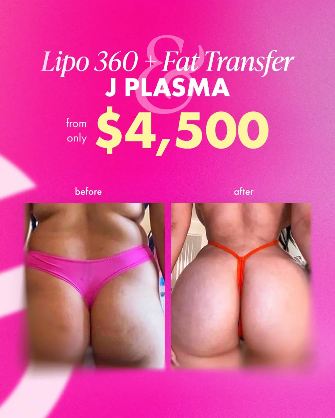@CG Cosmetic Surgery | Miami