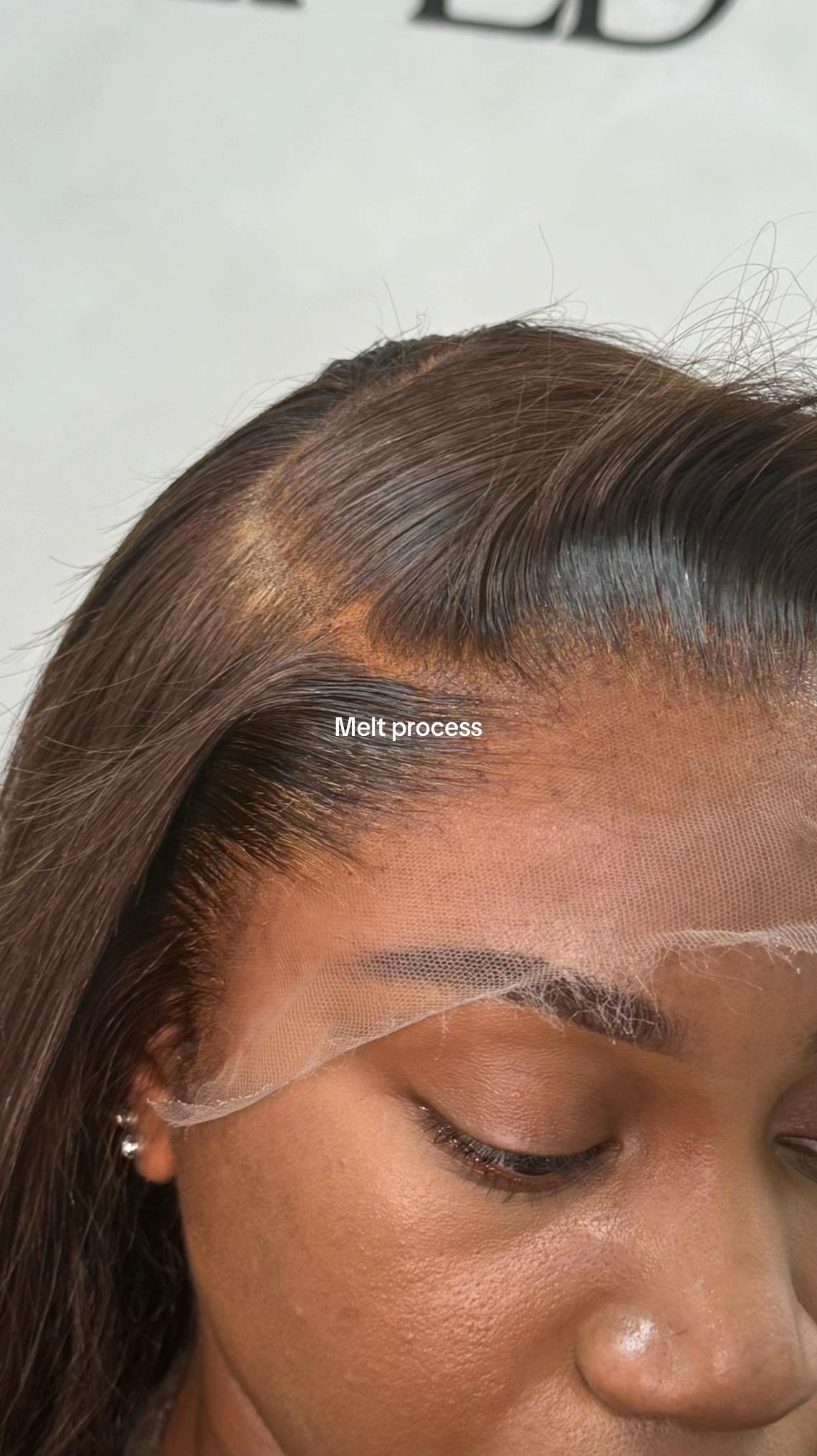 @SCALPEDIT