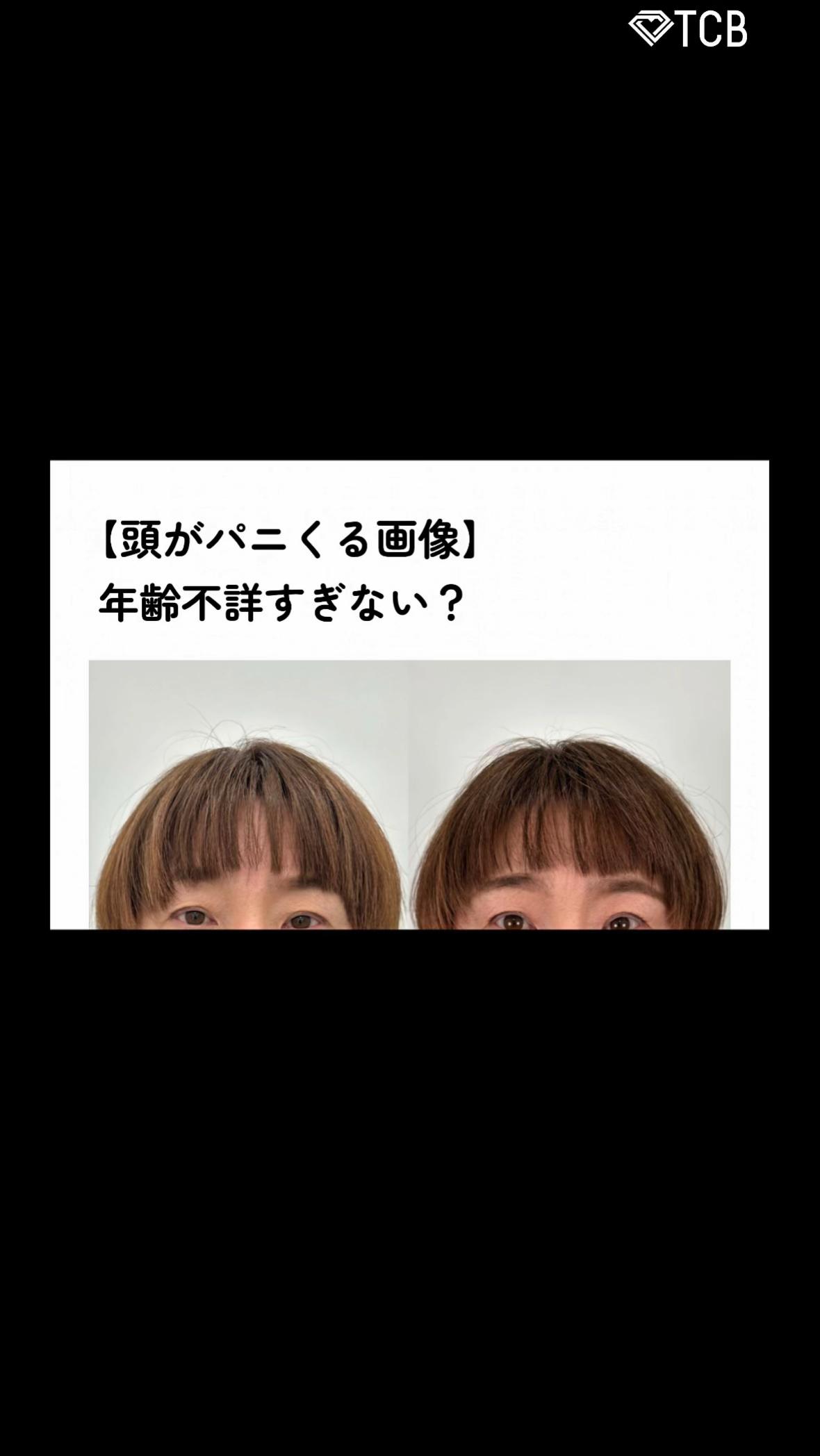 @【クマ取り/小顔整形】TCB京都駅前院 院長　橋本晋太朗