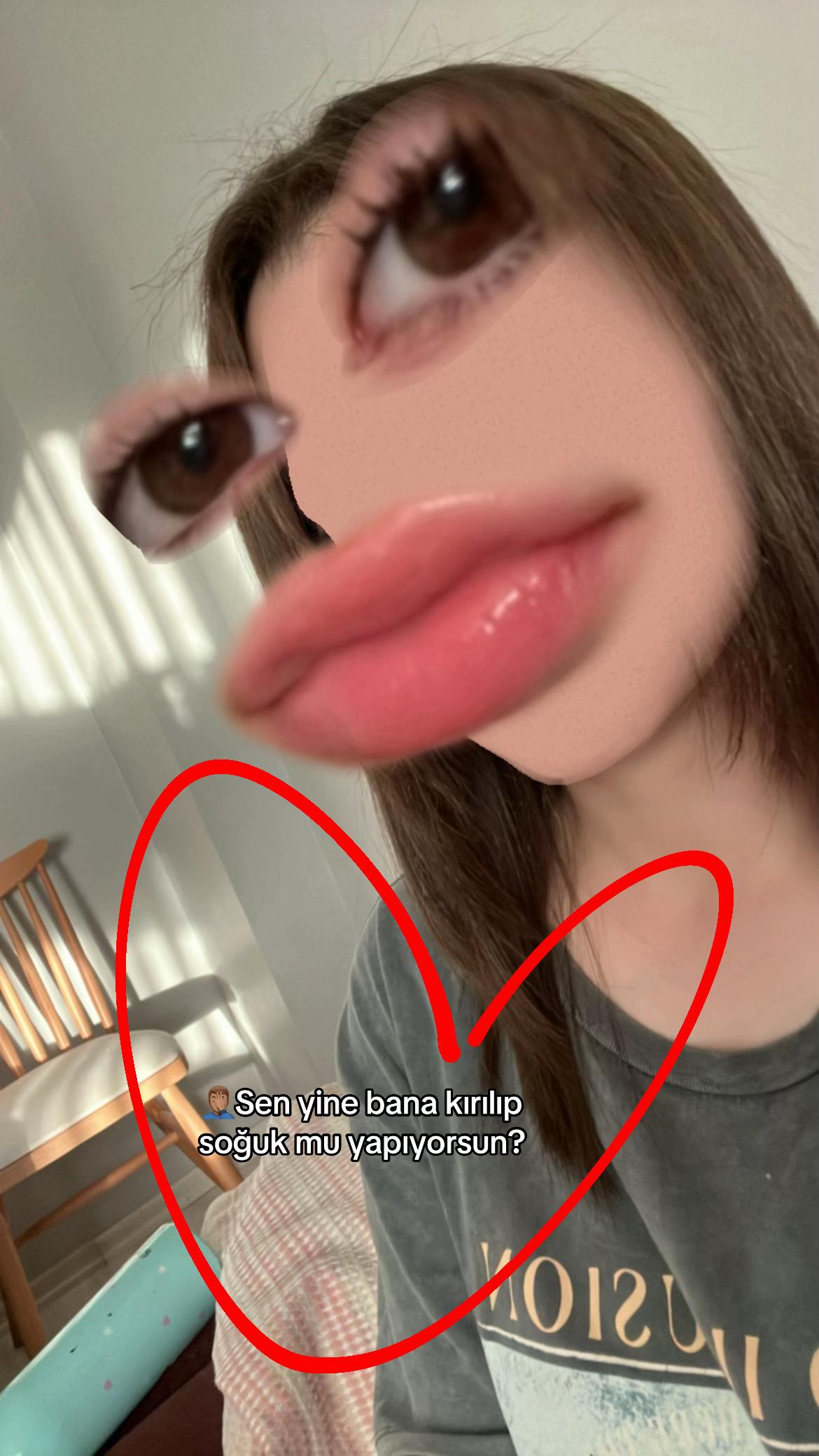 @Azra