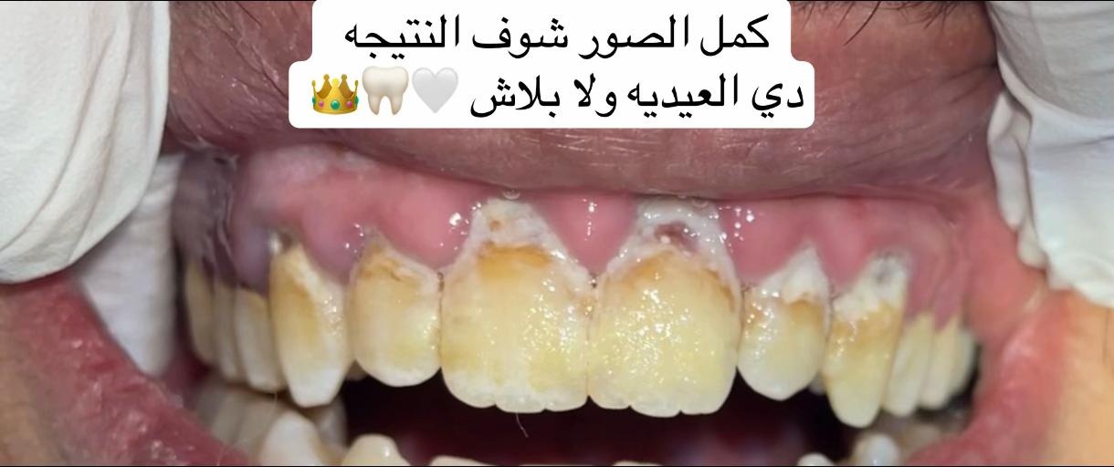 @Dr Mostafa Eita