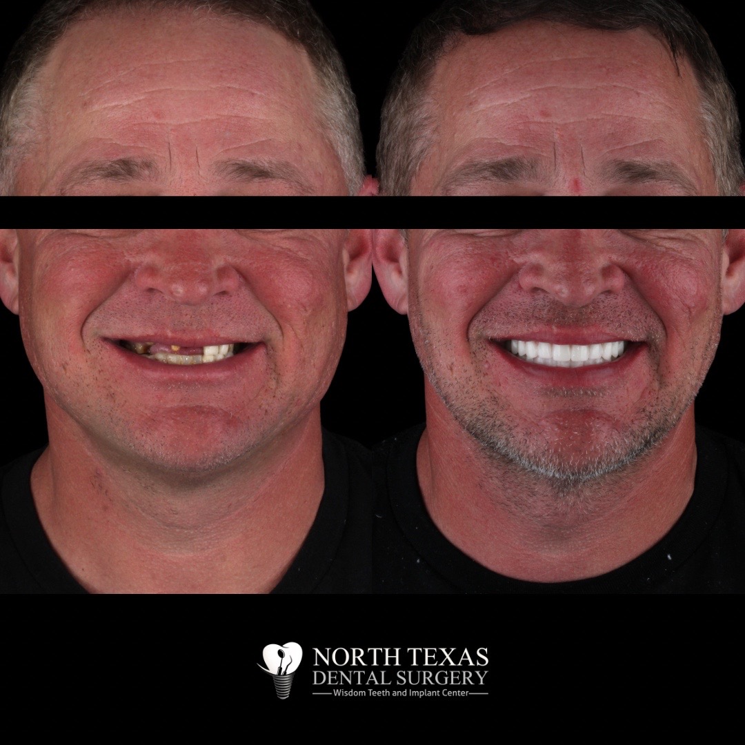 @Dallas Smile Specialists 🦷