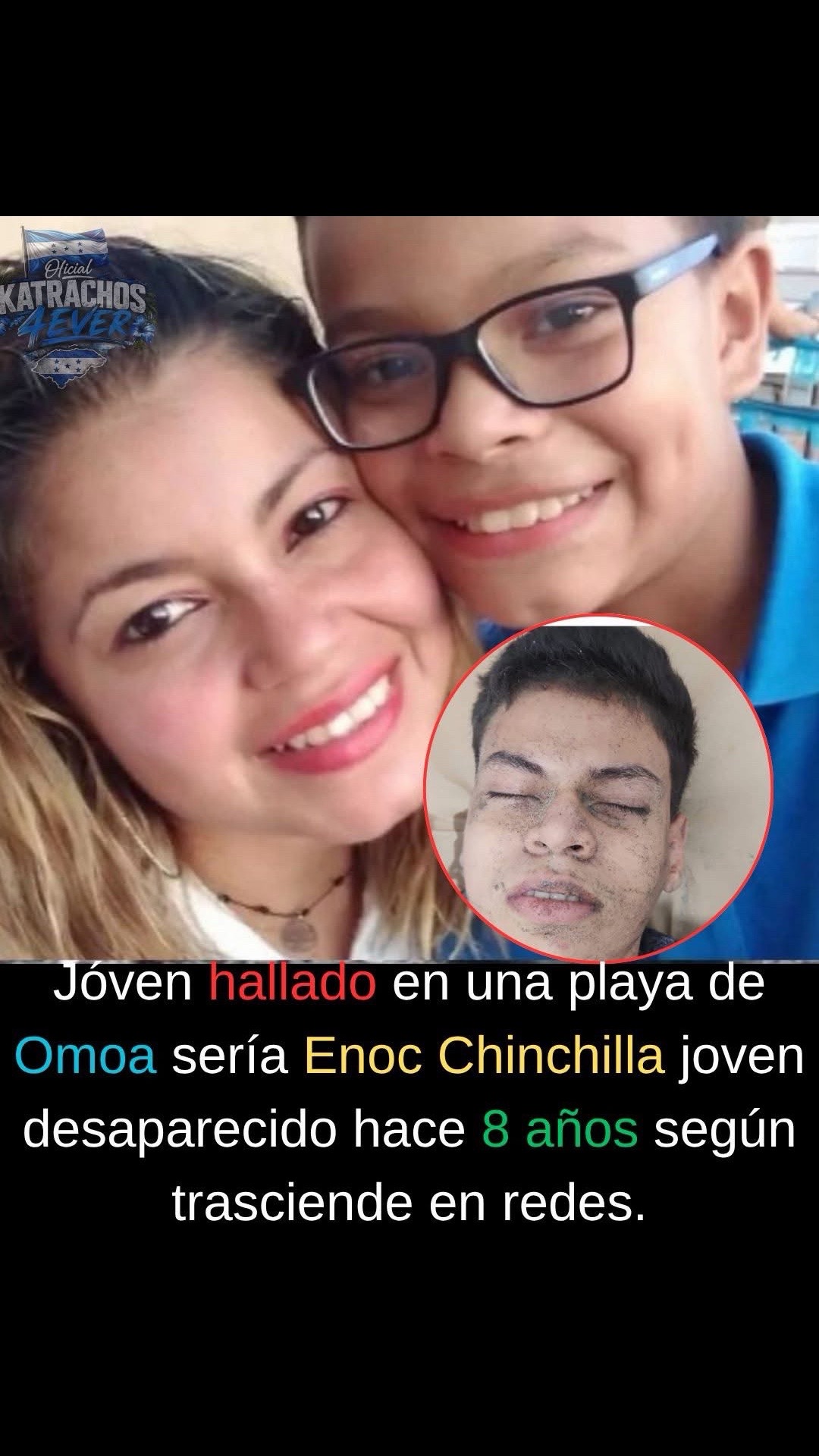 @Anil Gomez