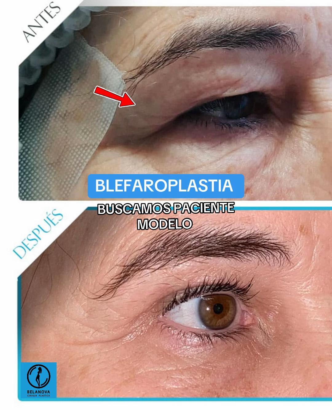 @Belanovacirugiaplastica