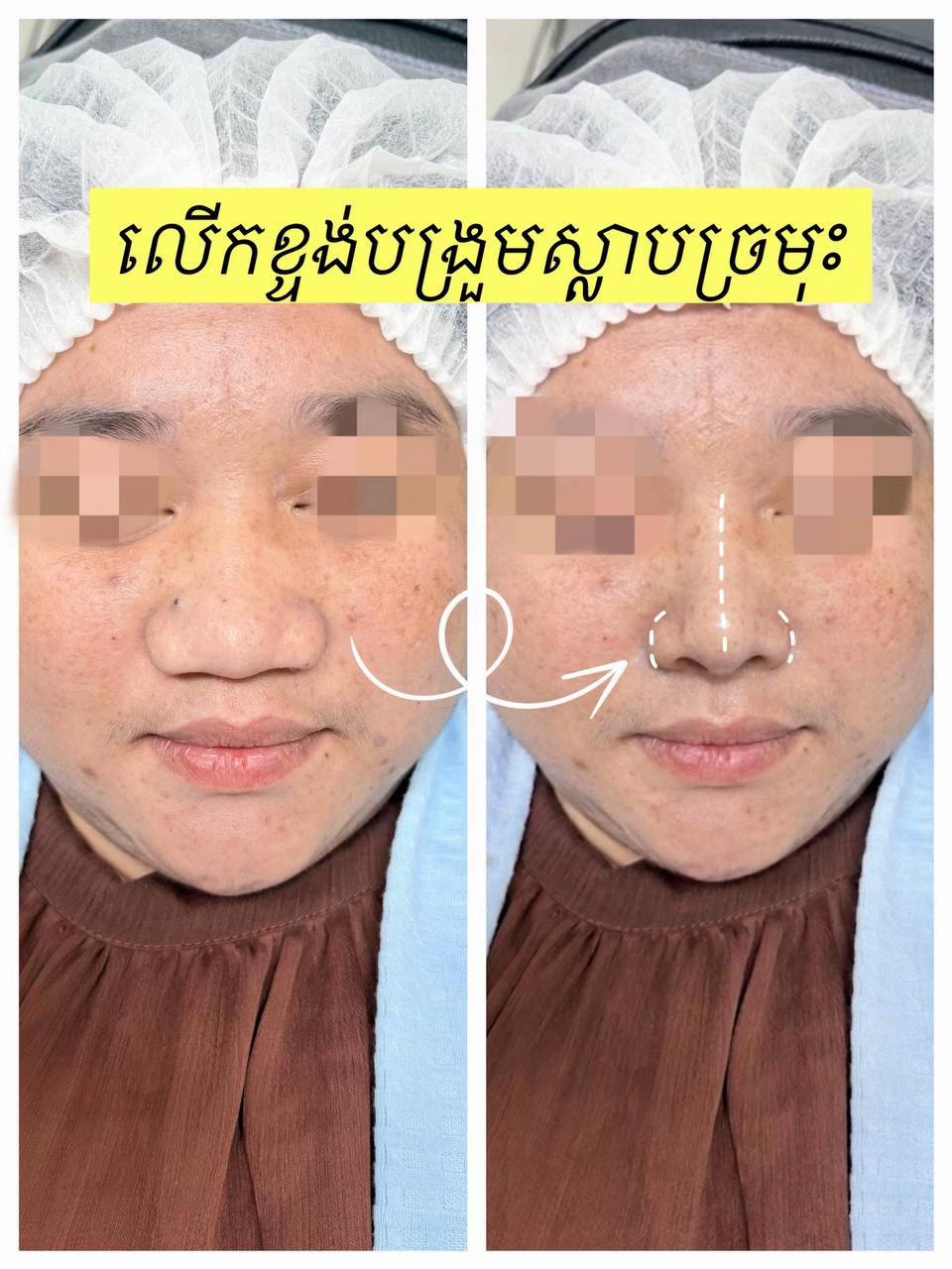 @fb:somneng sreng