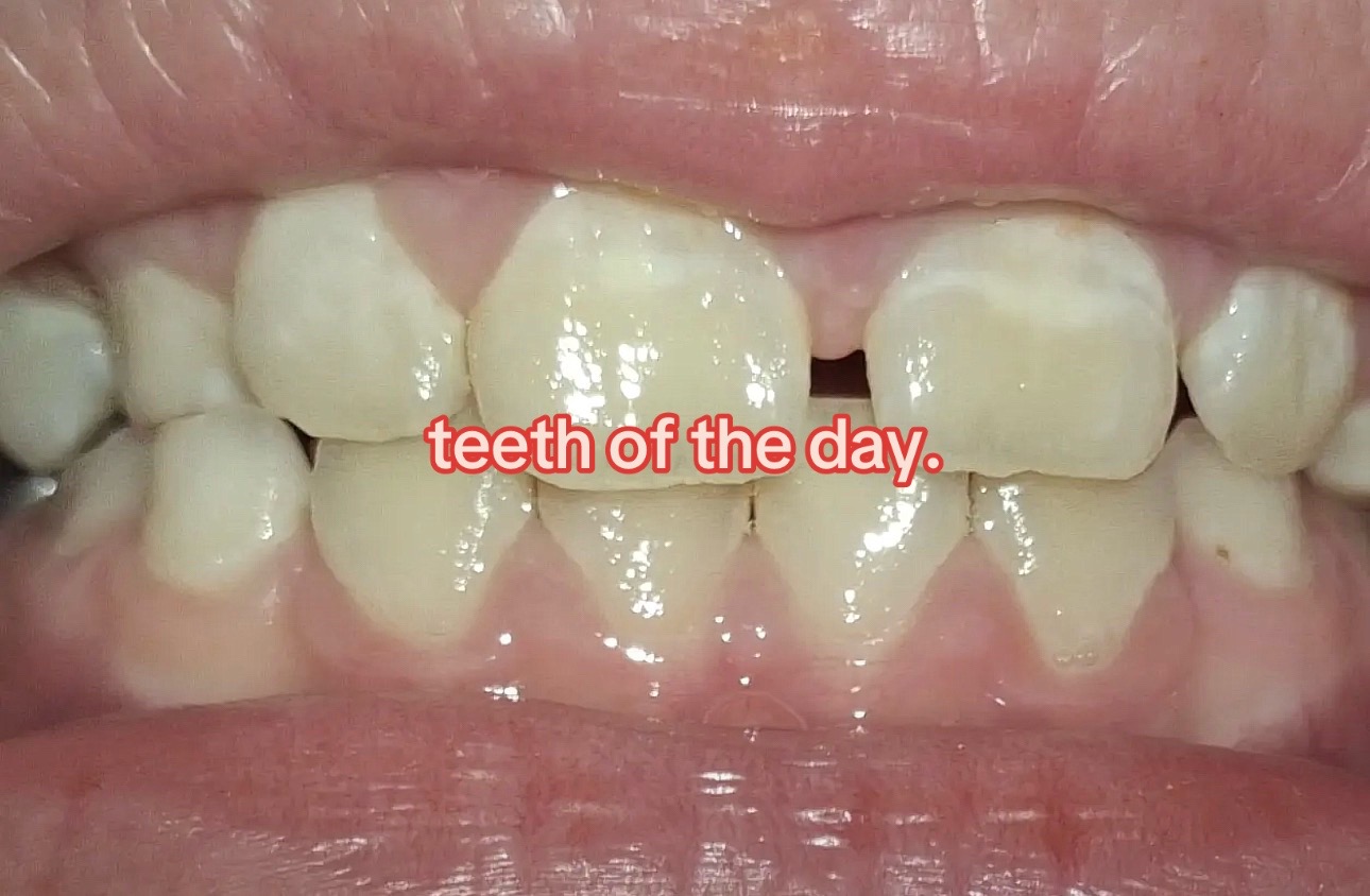 @I leik teeth moer thna mysefl.