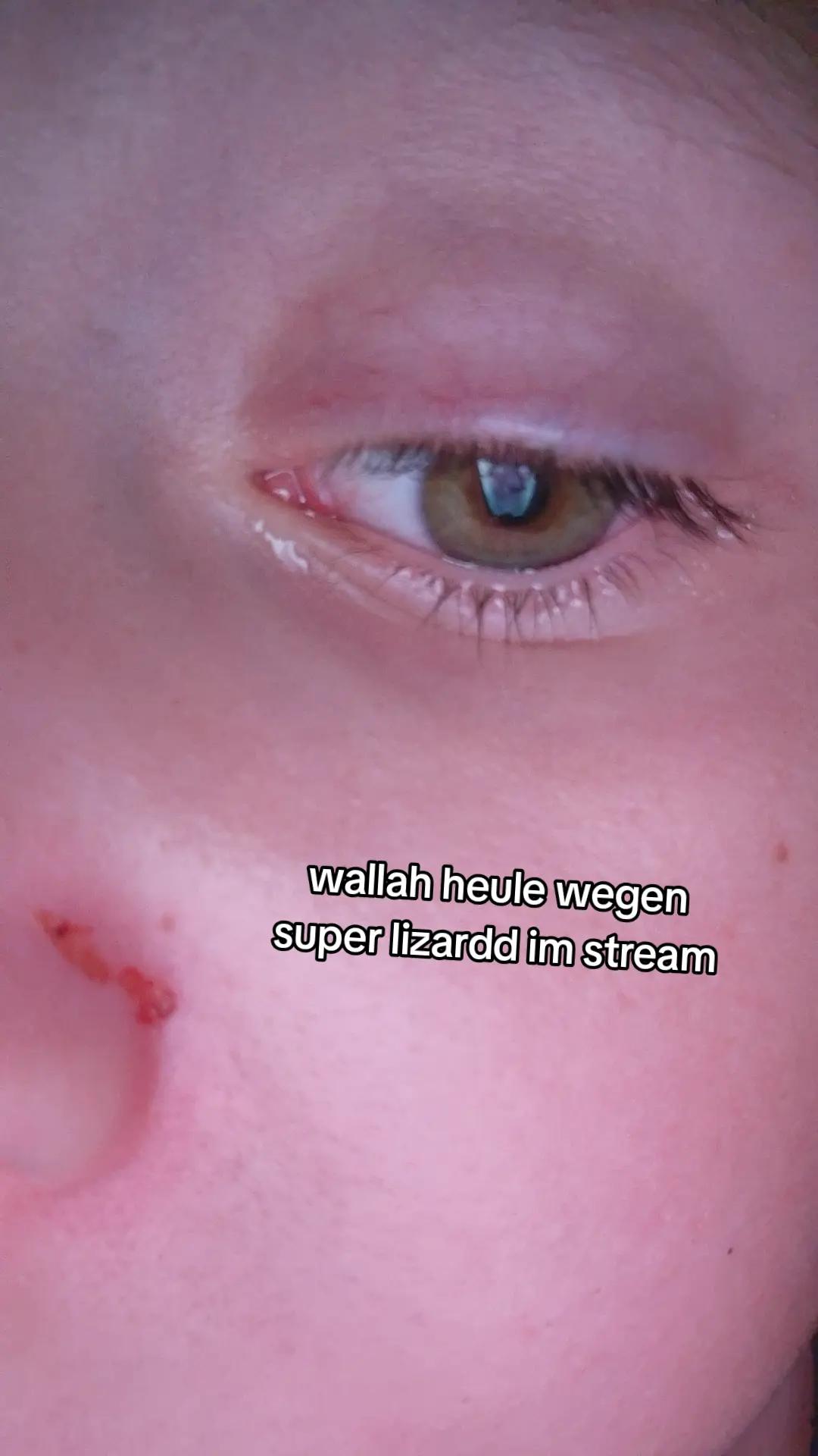 @x