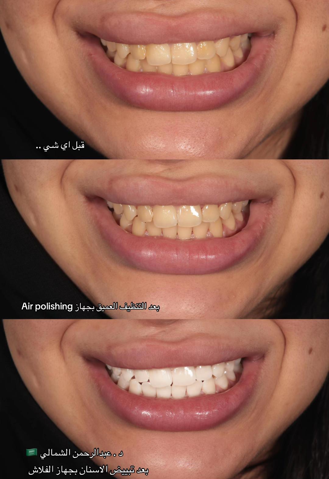 @مركز مزدانه 1 ( فرع الصحافه )