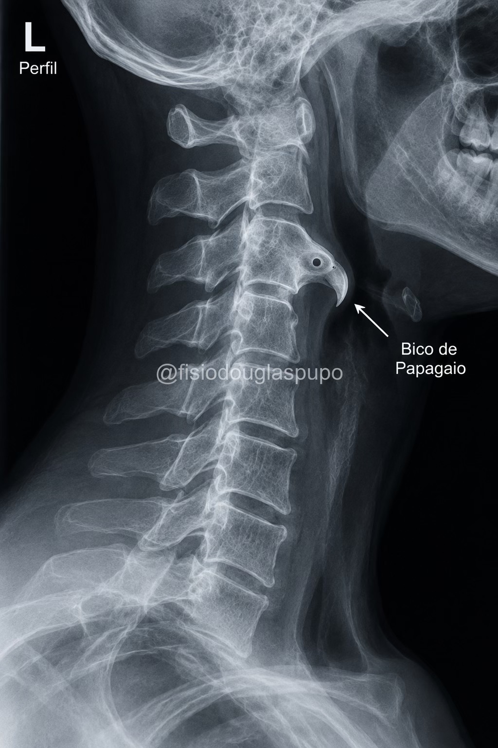 @fisiodouglaspupo