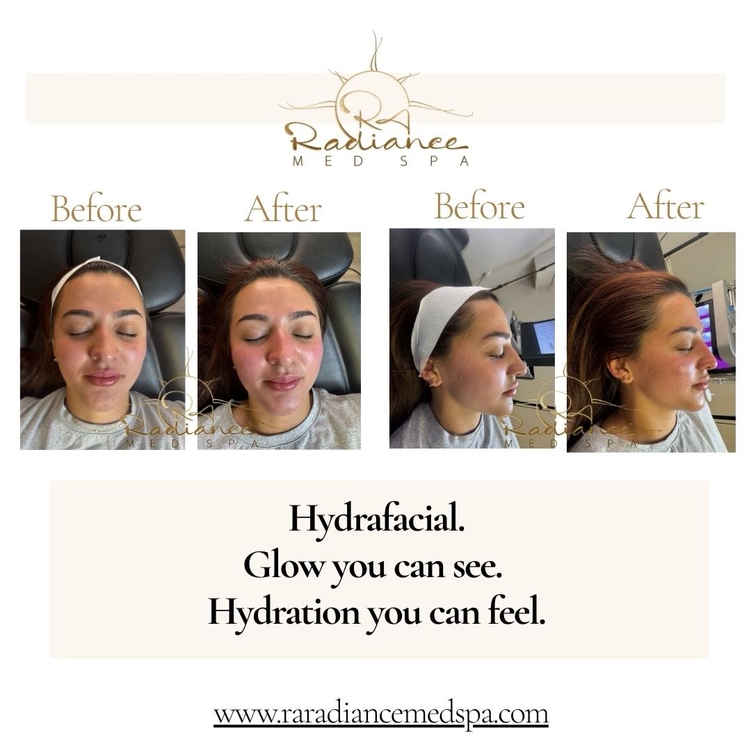 @RA Radiance Med Spa