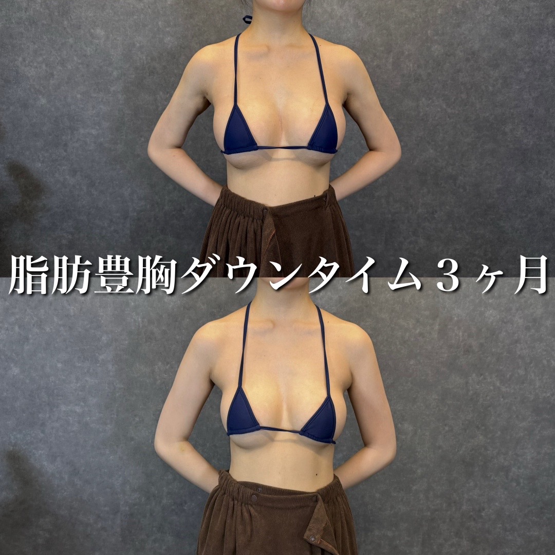 @森脇進/二の腕脂肪吸引・豊胸/AVAN TOKYO