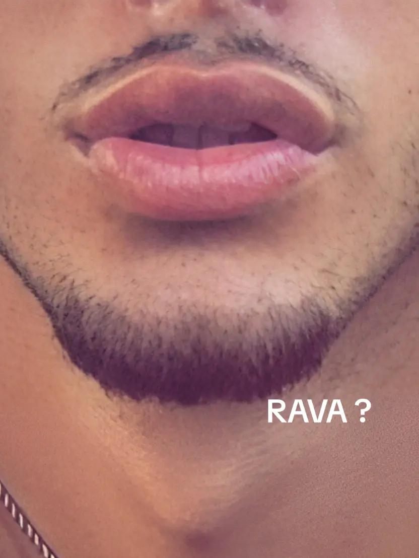 @Alex
