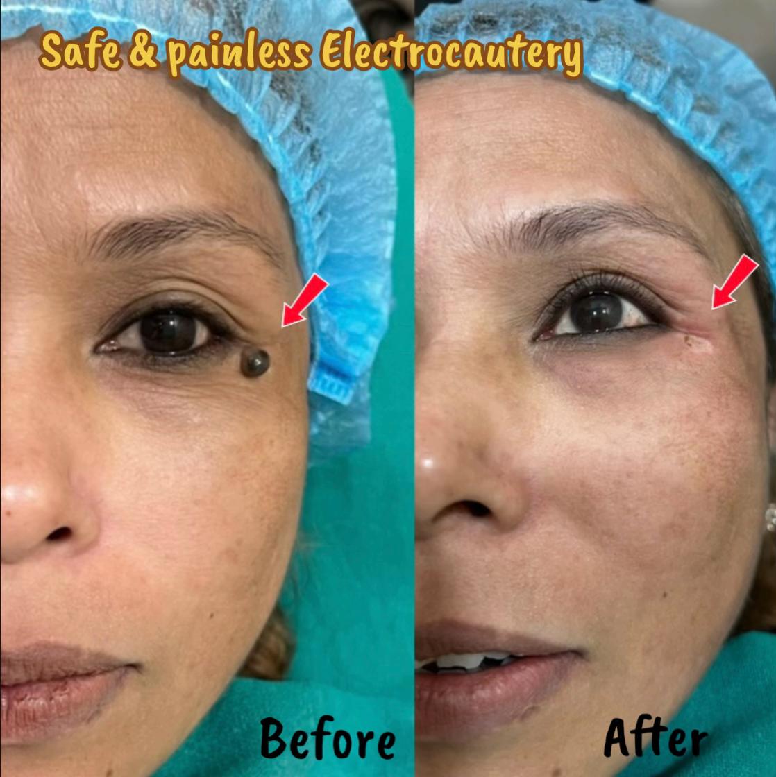 @Dr. Mainali, plastic surgeon