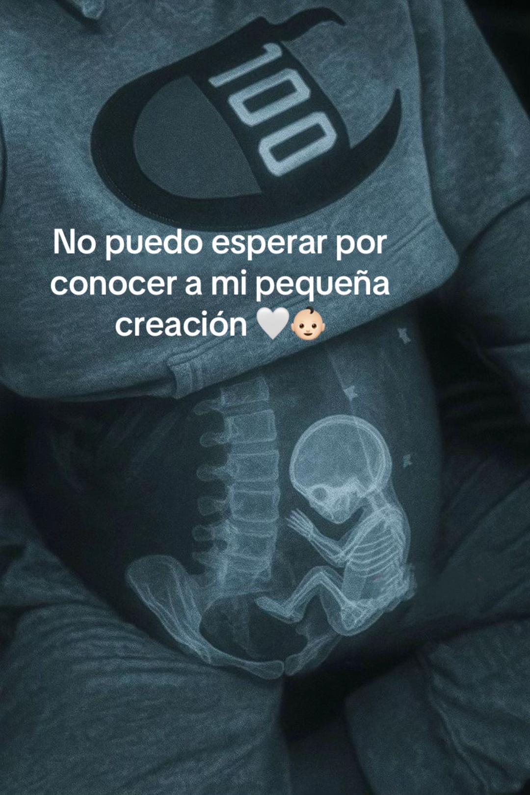 @Shoanaa