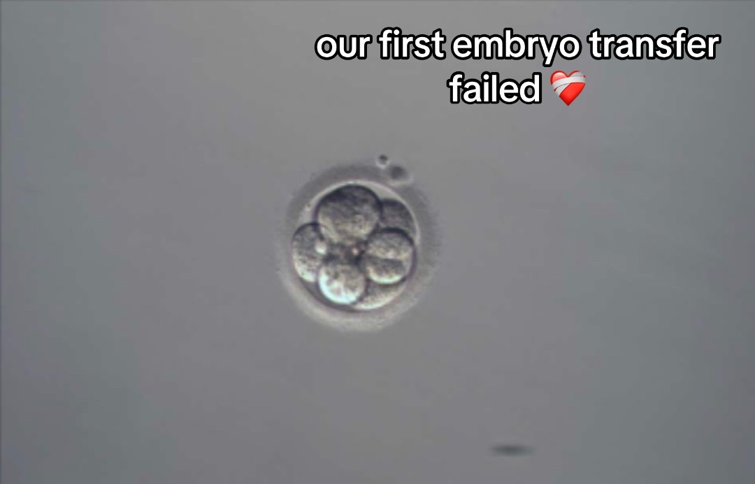 @Anna | IVF Journey