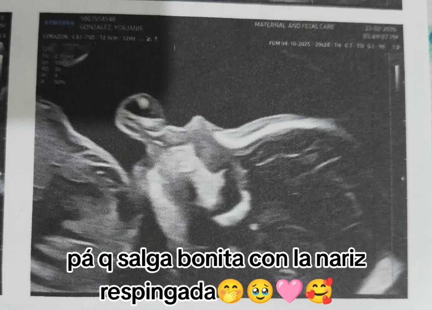 @Yorjanis Gonz&aacute;lez❤️