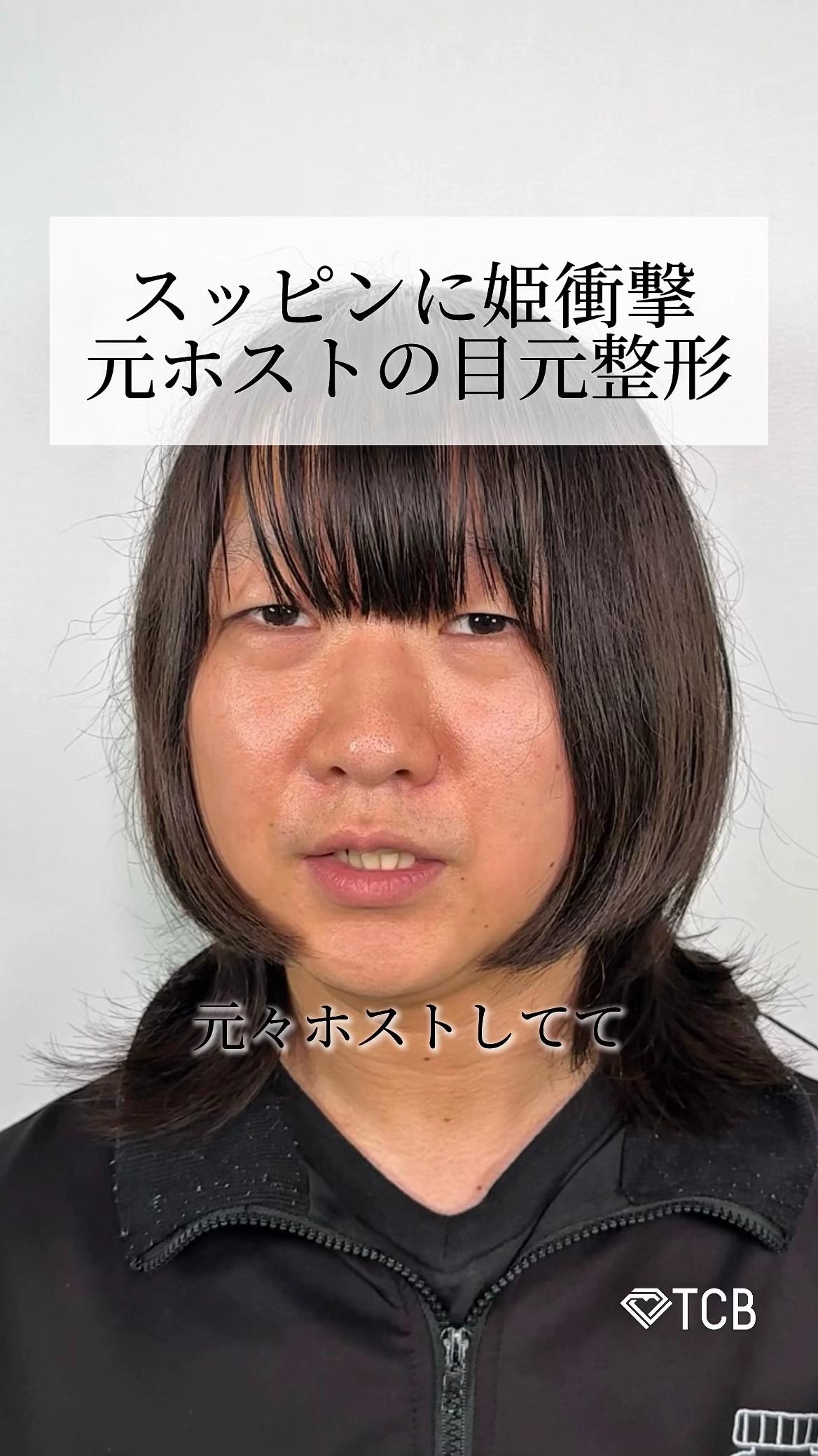 @【二重整形】TCB 新宿東口院ゆいこ先生/東京