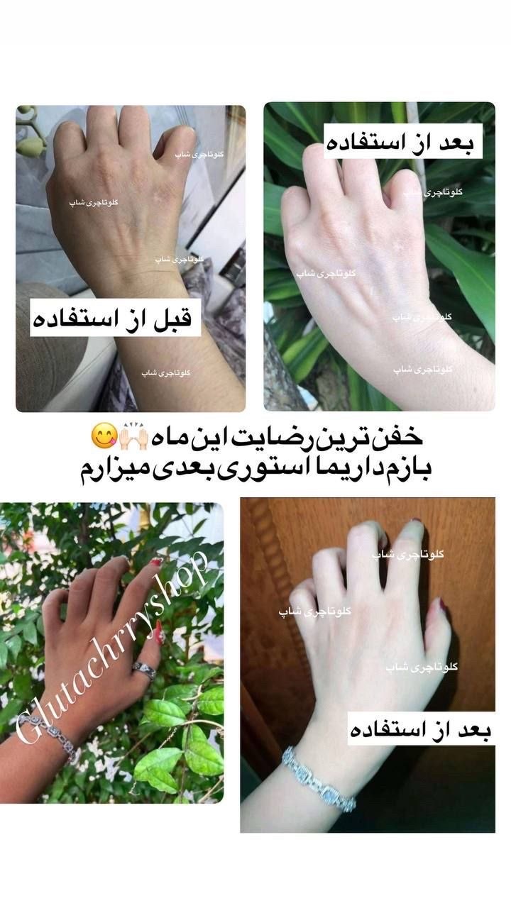 @گلوتاچری شاپ