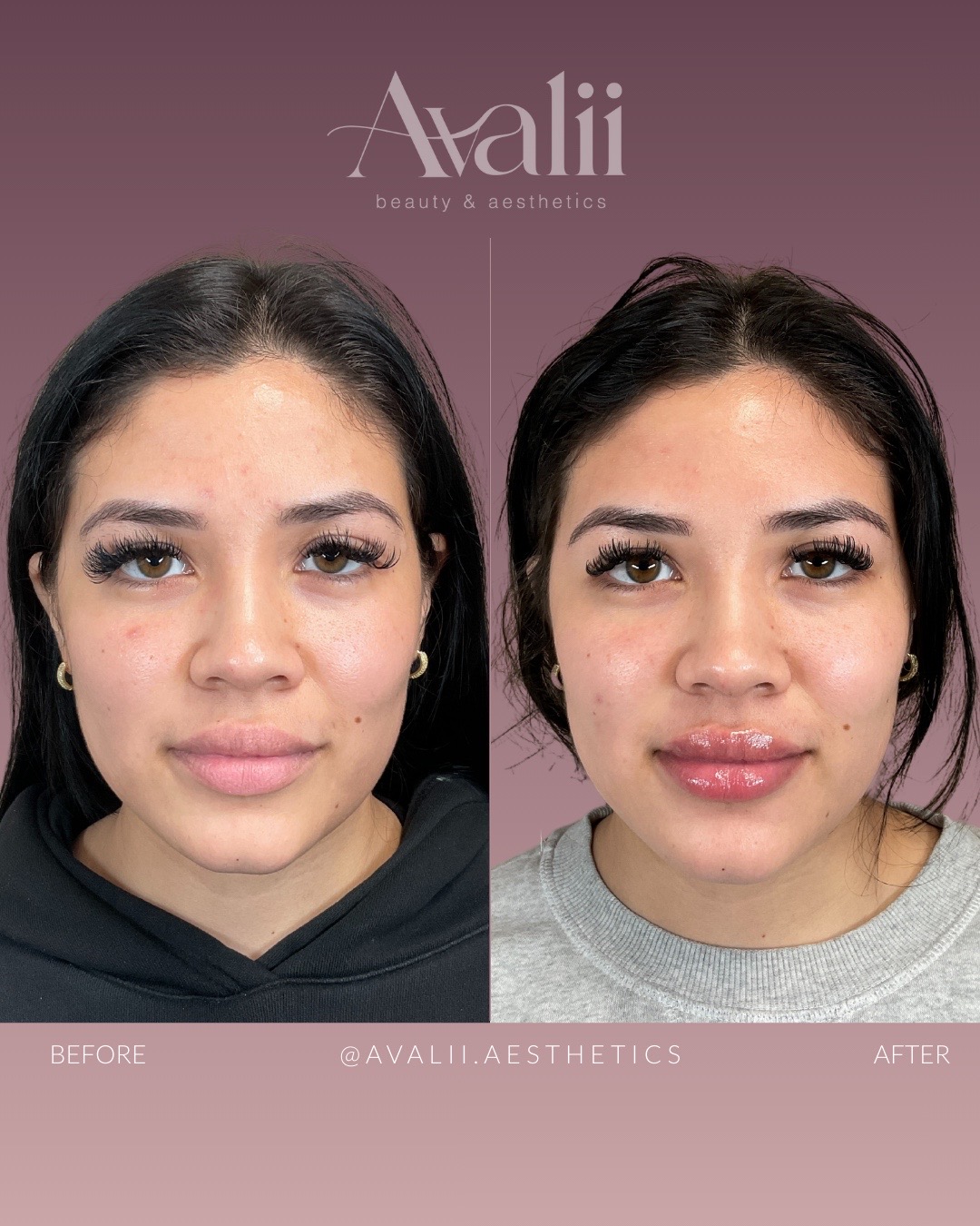 @Avalii Aesthetics