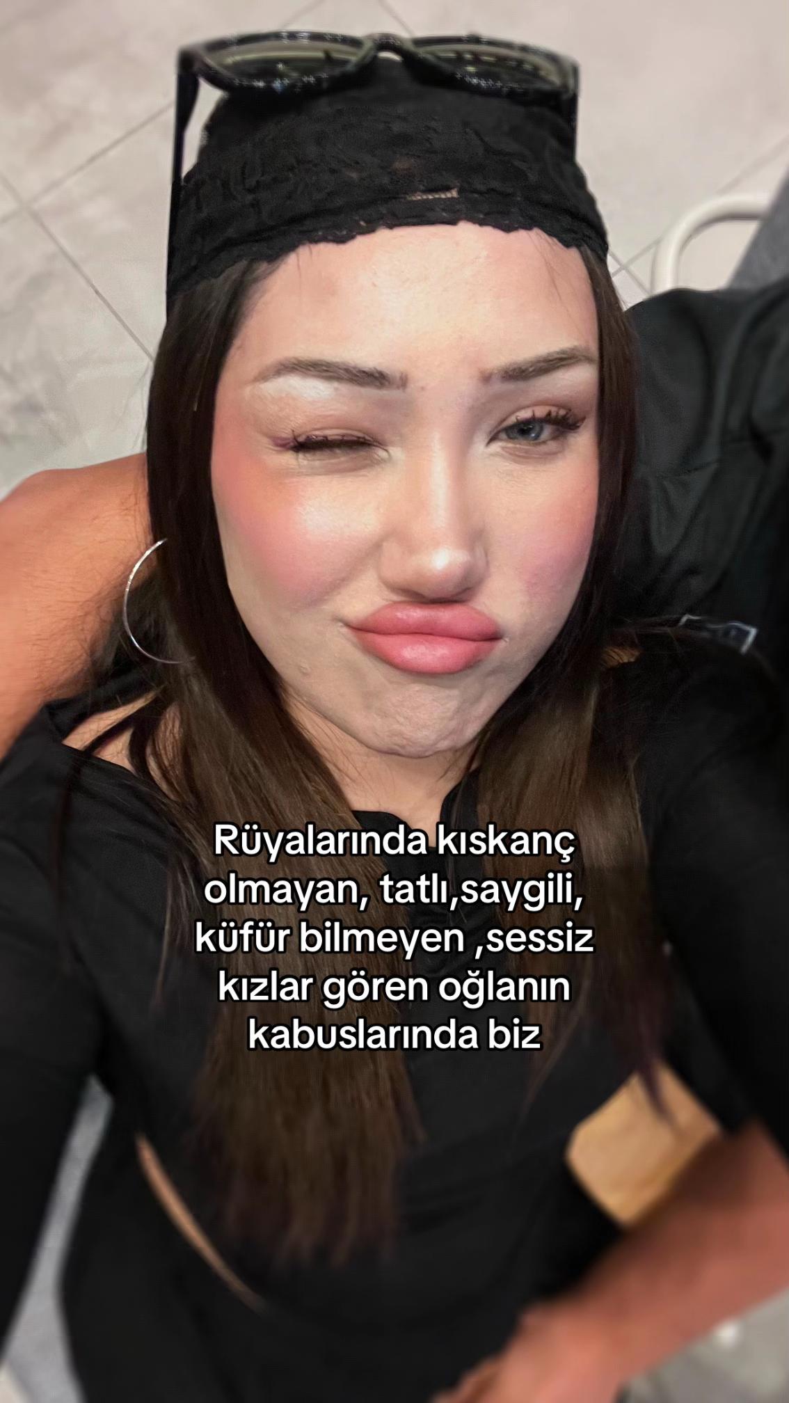 @Lale🪬