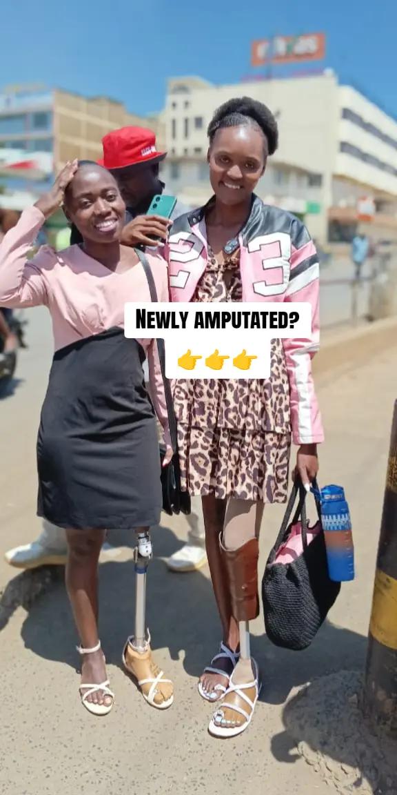 @Amputee girl