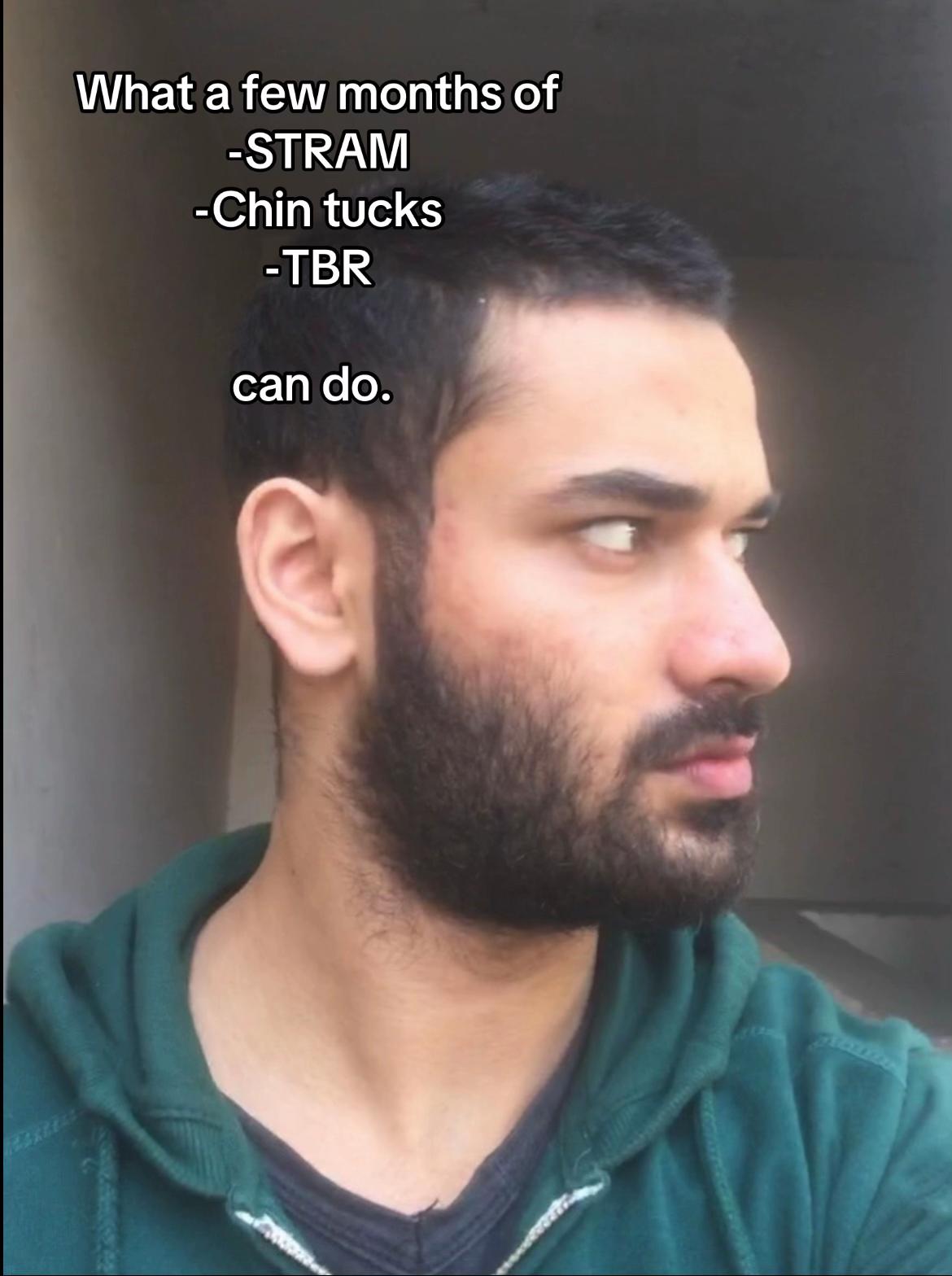 @Salludon