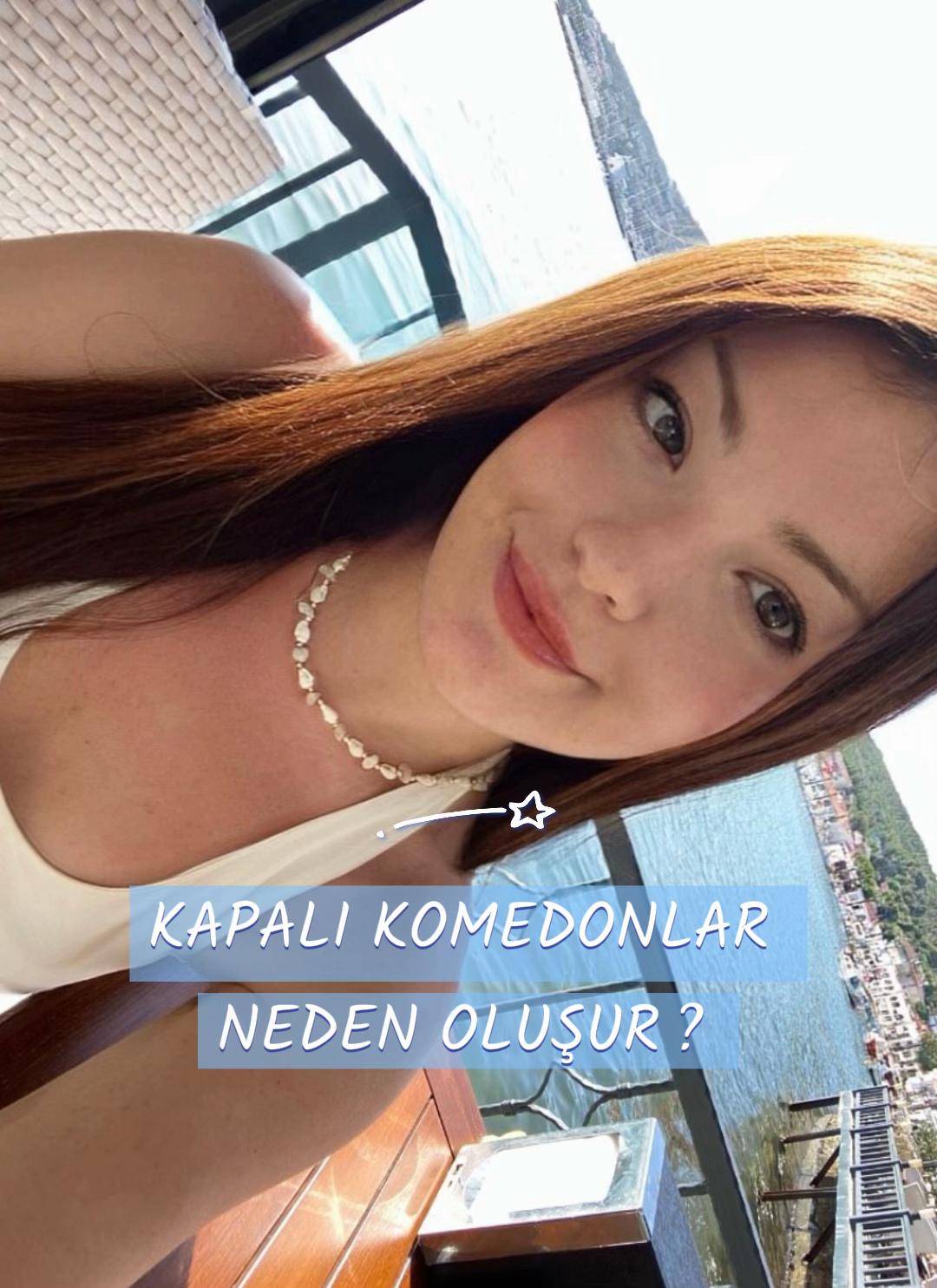 @𝚂ena🎀