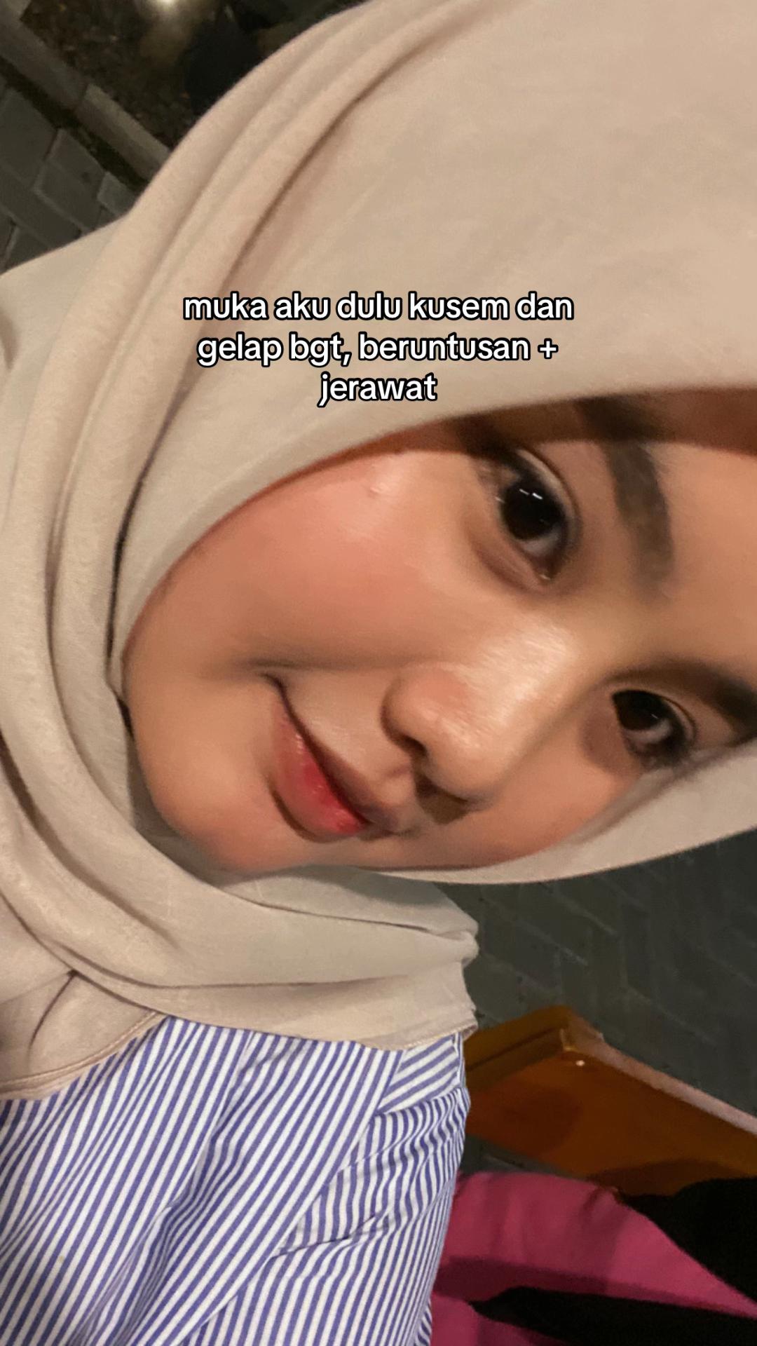 @bungaeuy