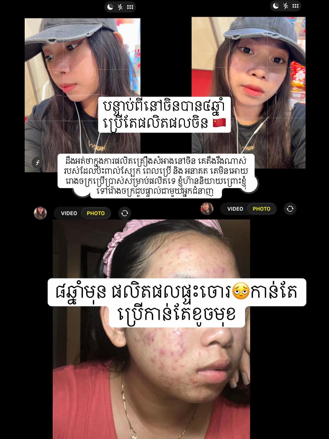 @แแธ-Chen JinNing๐ฐ๐ญ