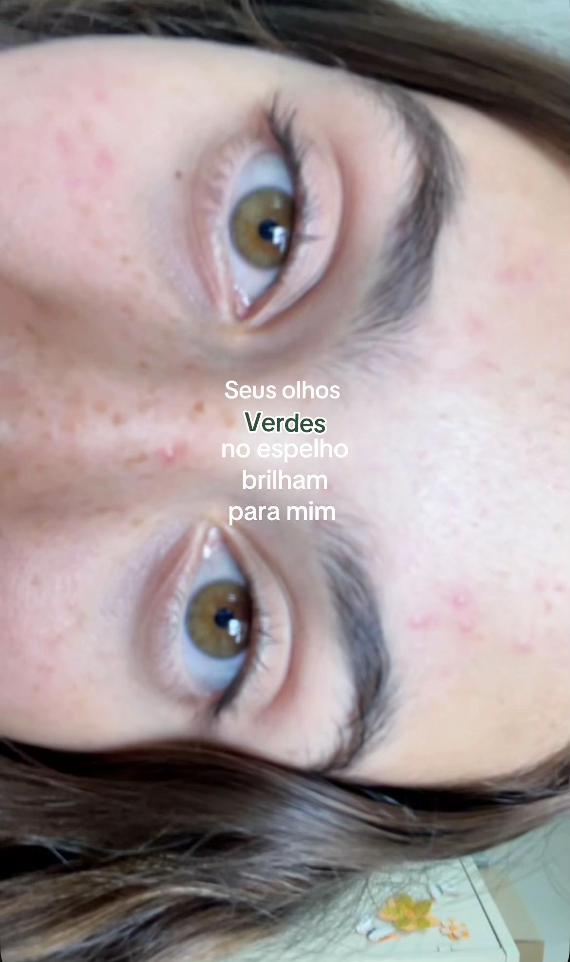 @Analu
