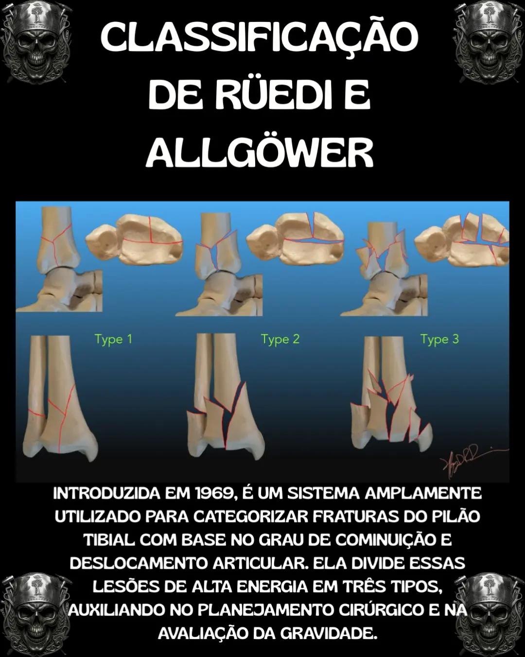 @Traumatologia Maluca