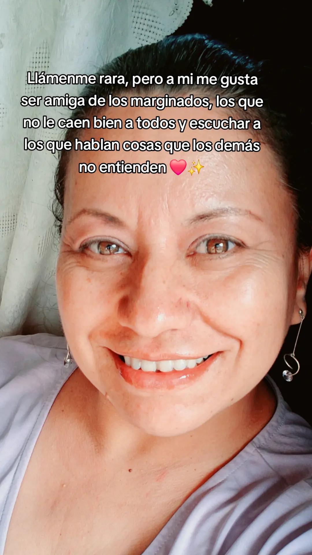 @Móɳιƈα Mσɠσʅʅóɳ ✨️💕